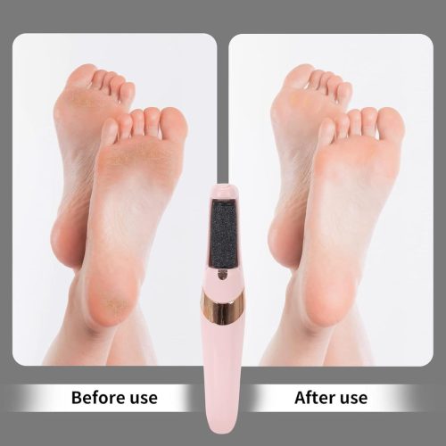 682a494d-8129-4270-82db-5bdcf60a52be ইলেকট্রিক ফুট পেডিকিউর টুলস, রিচার্জেবল ফুট ক্যালাস রিমুভার পেডিকিউর মেশিন