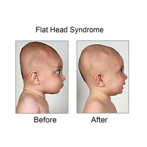 Newborn Baby Head Shaping Pillow For Sleeping