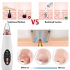 Multi-functional cleaning Blackhead Remover