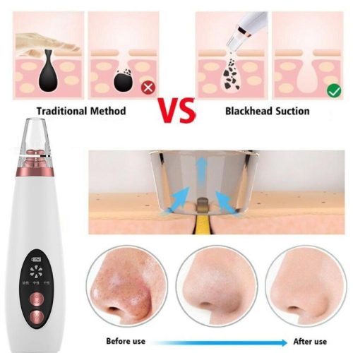 Multi-functional cleaning Blackhead Remover