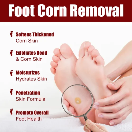 সাউথ মুন ফুট কর্ন রিমুভাল জেল (South Moon Foot Corn Removal Gel)